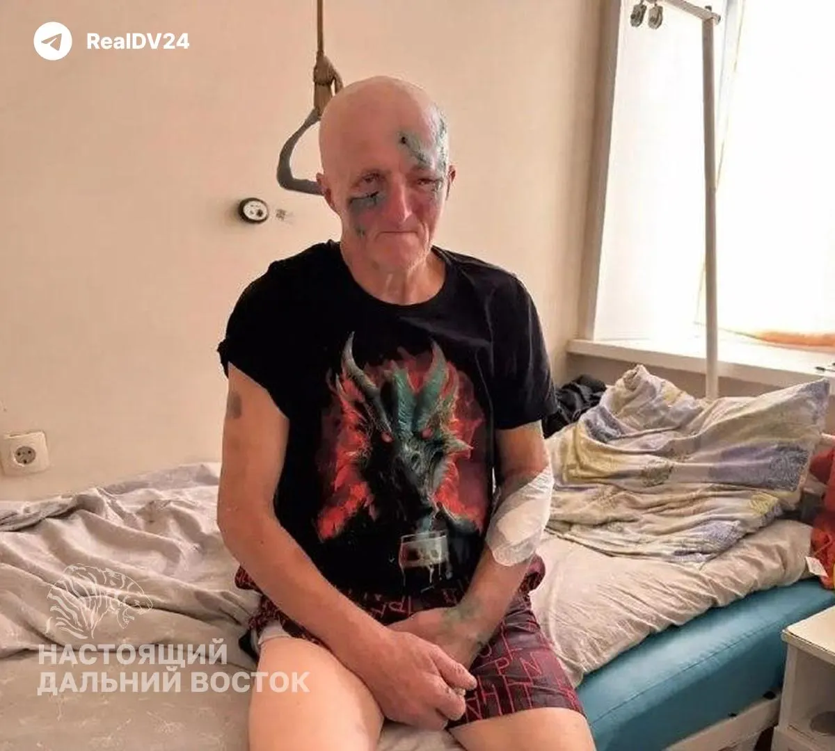 В регионе Дальнего Востока зафиксирована волна нападений медведей на людей и случаи возле населённых пунктов; заповедники ограничивают доступ, предпринимаются профилактические меры.